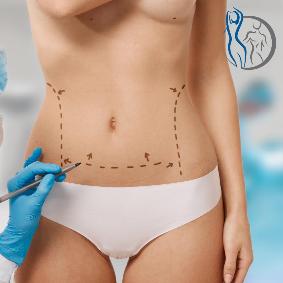 Lipectomia con Lipotransferencia en Bogotá