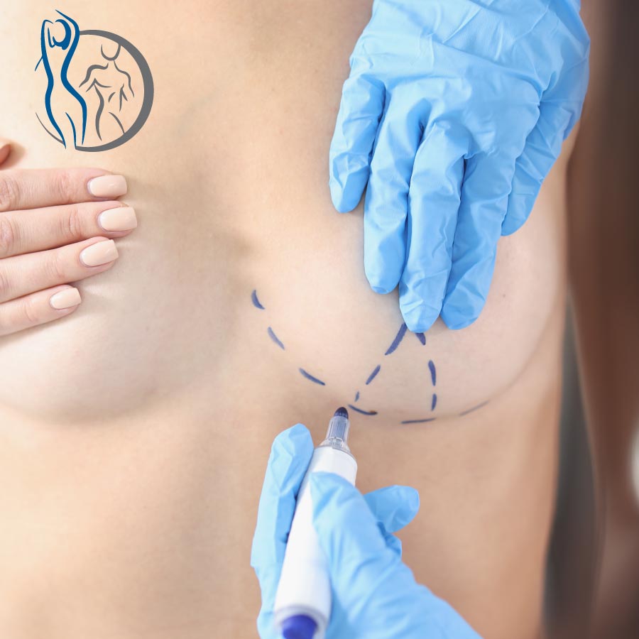 Mamoplastia de aumento en Bogotá