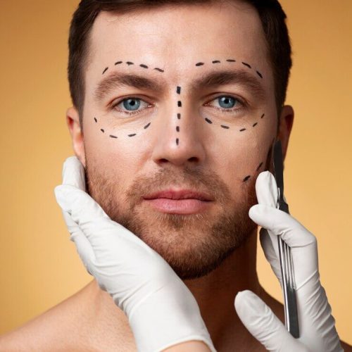 Blefaroplastia Bogotá precio